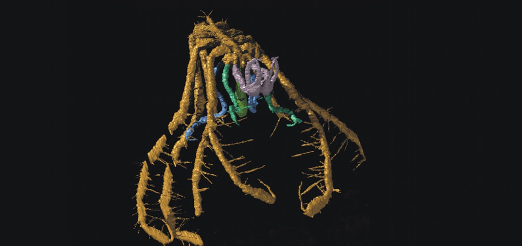 A fossil sea spider, pycnogonid arthropod, from the Silurian of Herefordshire, UK